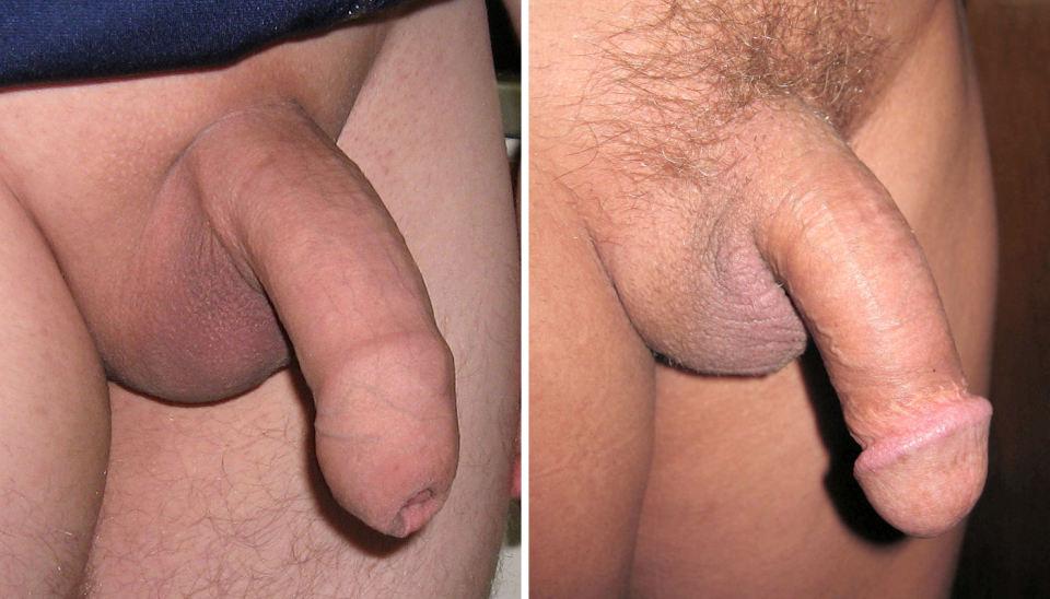 Dick uncircumcised sex with Login